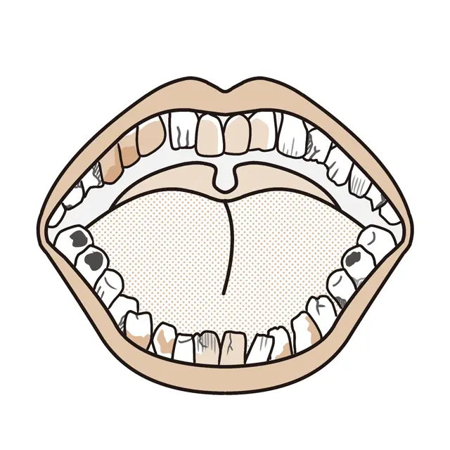 歯は「見た目」が大事！ 大人の「歯」を残念印象にする4つの要素とは？