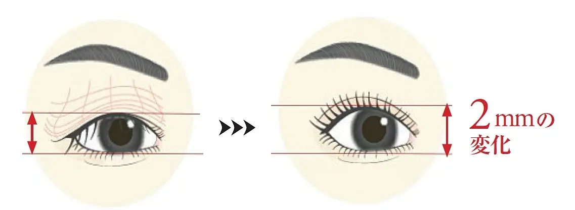 スムーズに開閉できるようにしなやかで柔らかい半面、伸びやすいまぶたの皮膚。その2 ㎜（’24年7月実施・資生堂調査 20〜50代女性400名）を取り戻すため、今すぐケアを。