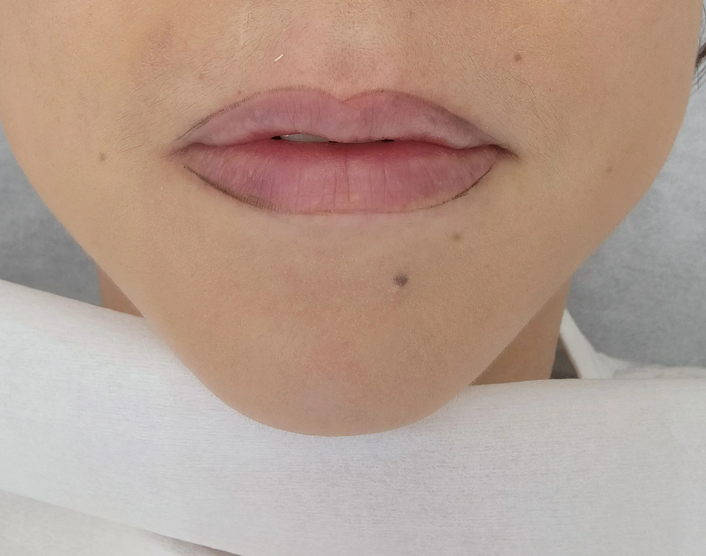 BEFORE