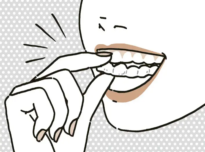 セルフケアもさらに重要に 【マウスピース矯正】