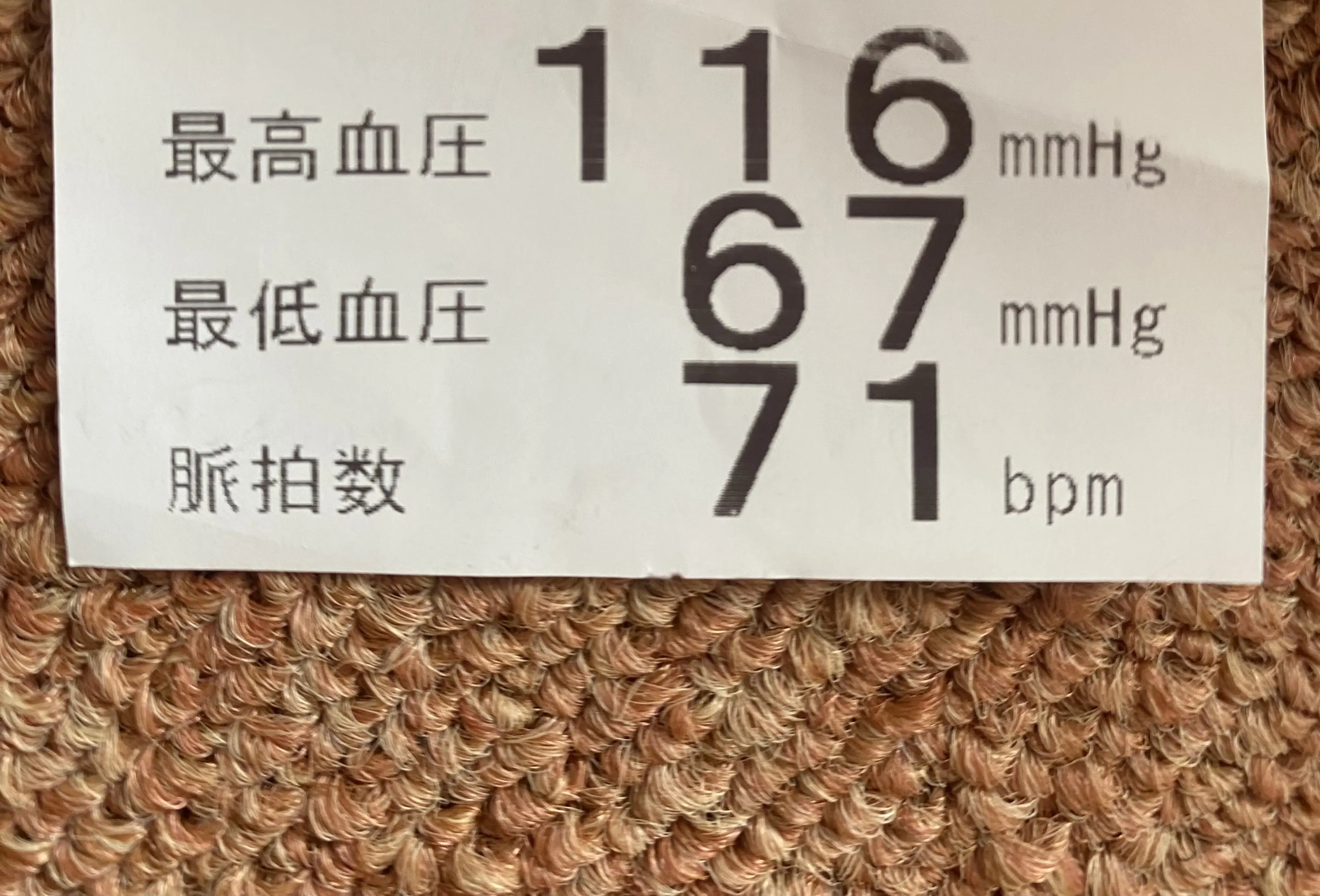 血圧測定