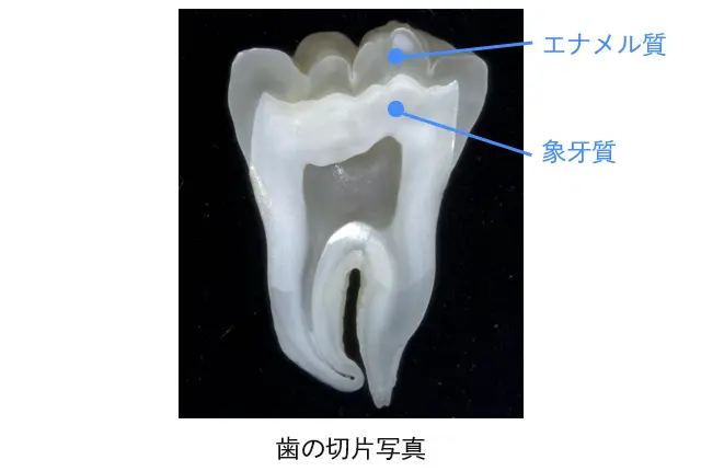 歯と歯ぐきを守る「アパデント」の特徴とは？