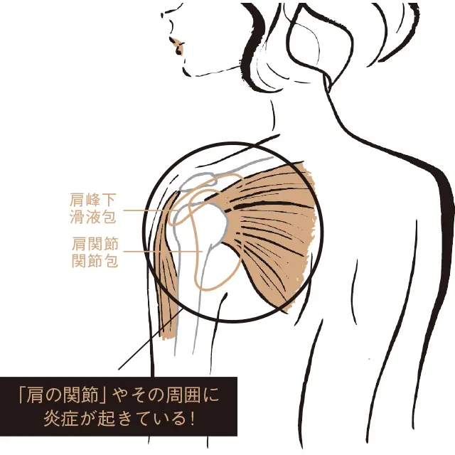 肩の関節