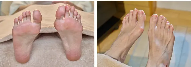 施術後