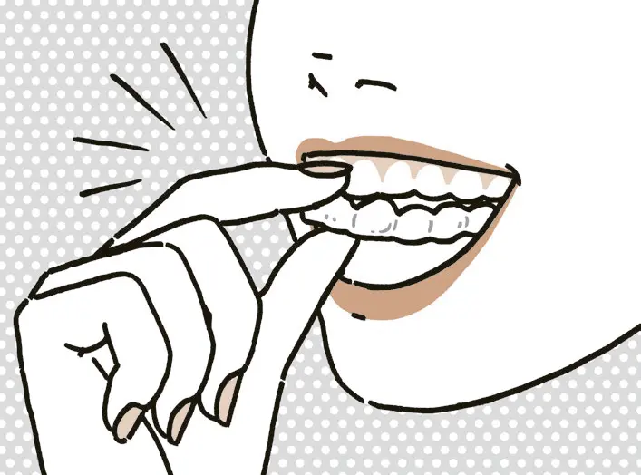 50代　歯並び　対策　マウスピース矯正　病院　歯列矯正　イメージイラスト