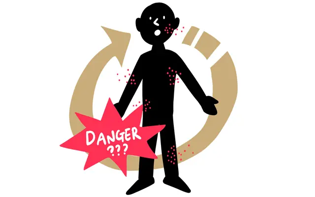 「帯状疱疹が体を一周すると危険」は本当？