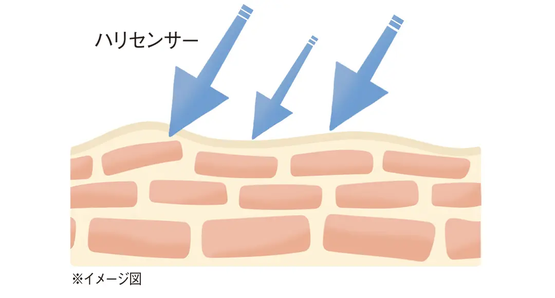 ハリセンサーイメージ図