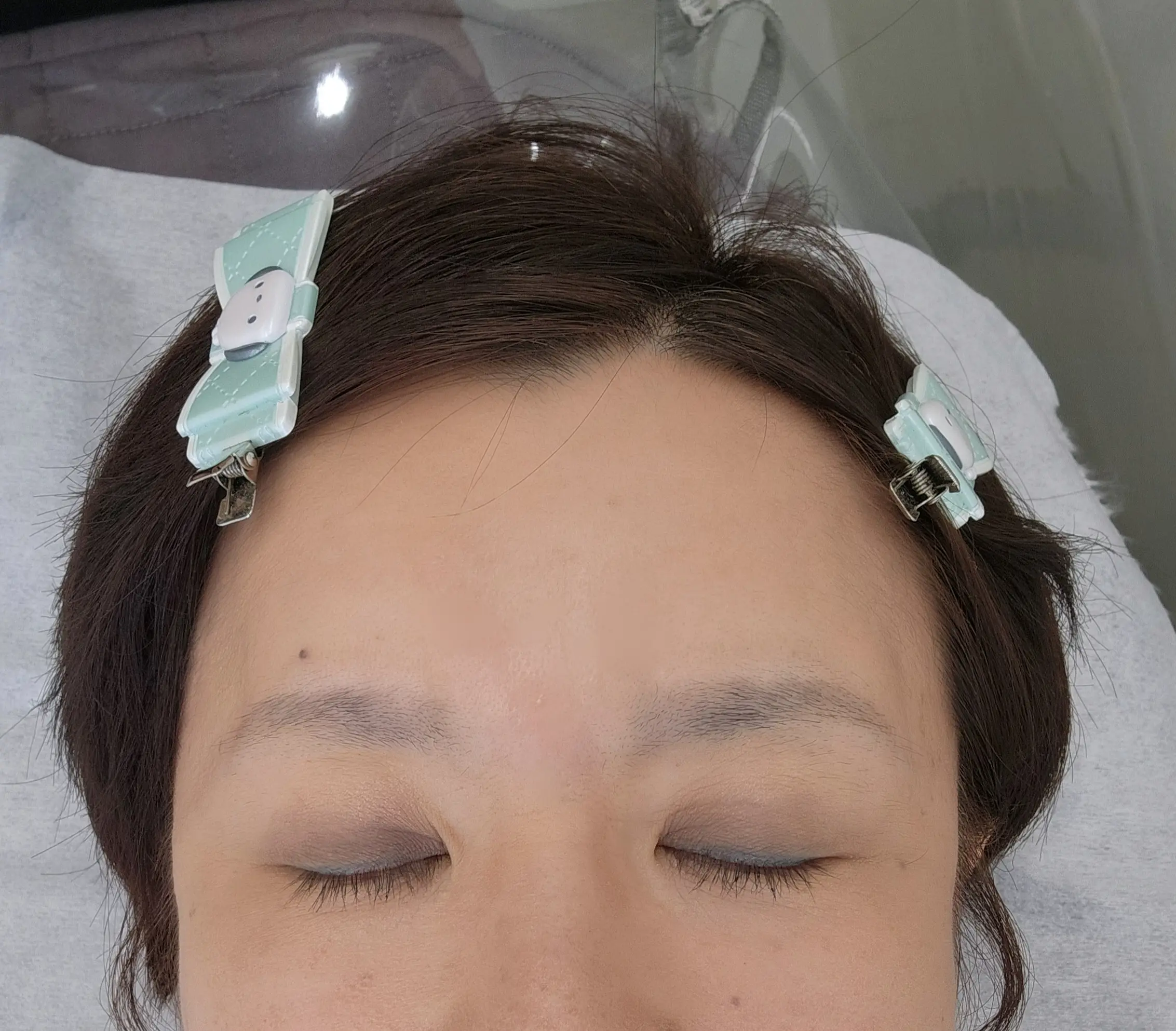BEFORE