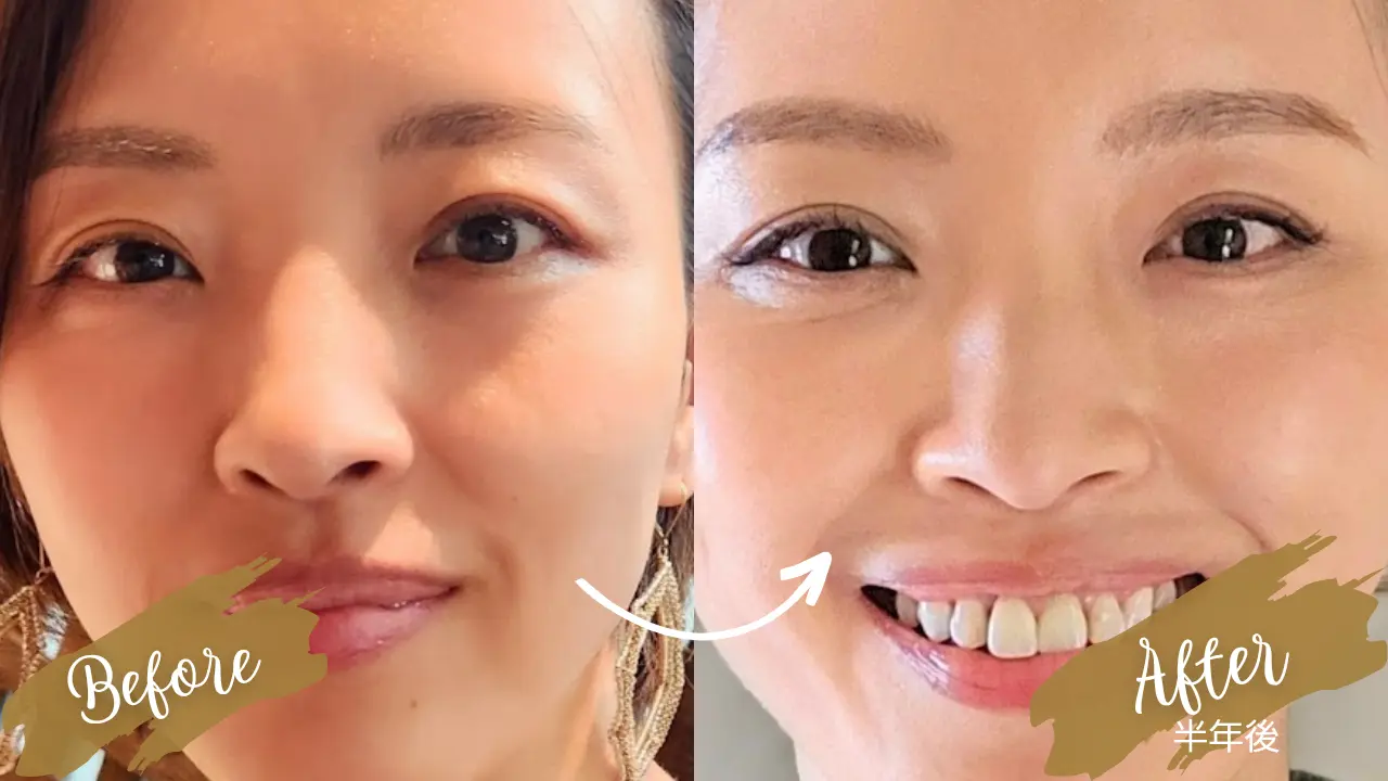 最近、笑顔になったのはいつですか？_1_6