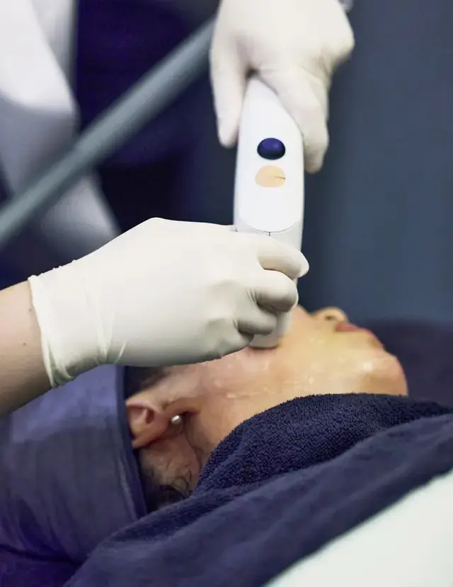 ソフウェーブ(W990,000~)は真皮層に超音波を照射し、コラーゲン生成を促進して肌のしぼみをふっくら