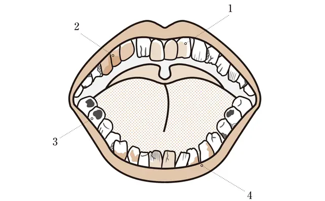 大人の「歯」を残念印象にする要素