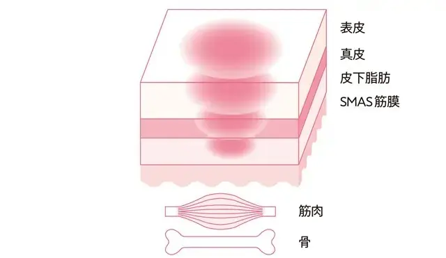 老け見えの原因は「たるみ毛穴」!? 50代が損する「たるみ毛穴」撃退方法まとめ_1_46