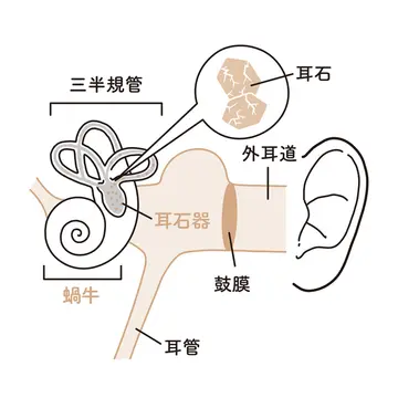 【50代に多い！めまいの原因&amp;対策】「良性発作性頭位めまい症」とは？原因と対策を解説