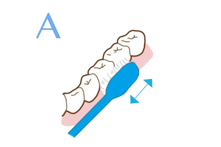 奥歯の表面