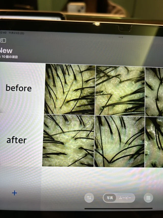 視界が開く、頭が軽い、髪質が変わる。 ヒト幹細胞培養液×極上空間の“銀座本格ヘッドスパ”体験！_1_8