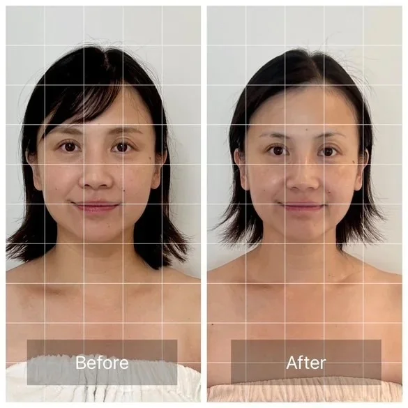 40代の最新美容まとめ｜美女組が“本当に効いた”ケア＆体験レポ_1_10