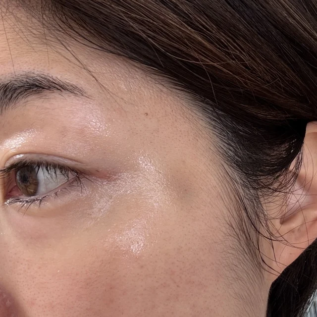 笑顔に自信を取り戻す!40歳からの美容医療デビュー_1_3