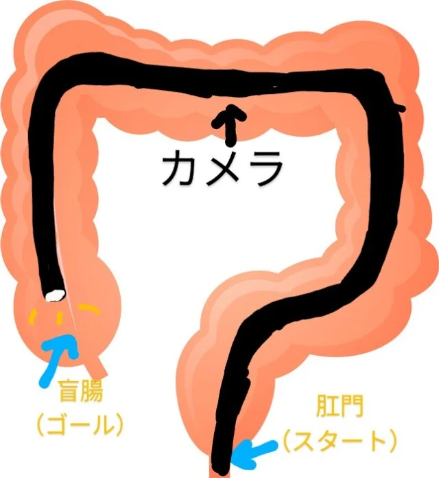 【人間ドック】現役内科医がオススメするつけるべきオプション検査とは？_1_4