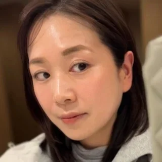 40代のたるみ対策｜美顔器・美容医療のリフトアップ方法３選_1_13-2