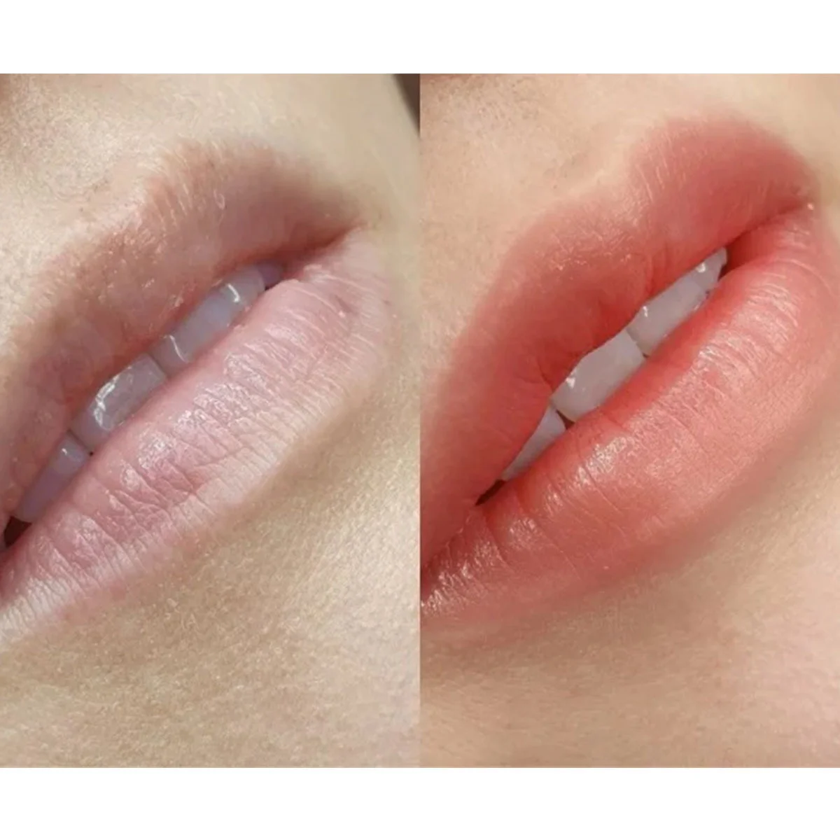 40代の最新美容まとめ｜美女組が“本当に効いた”ケア＆体験レポ