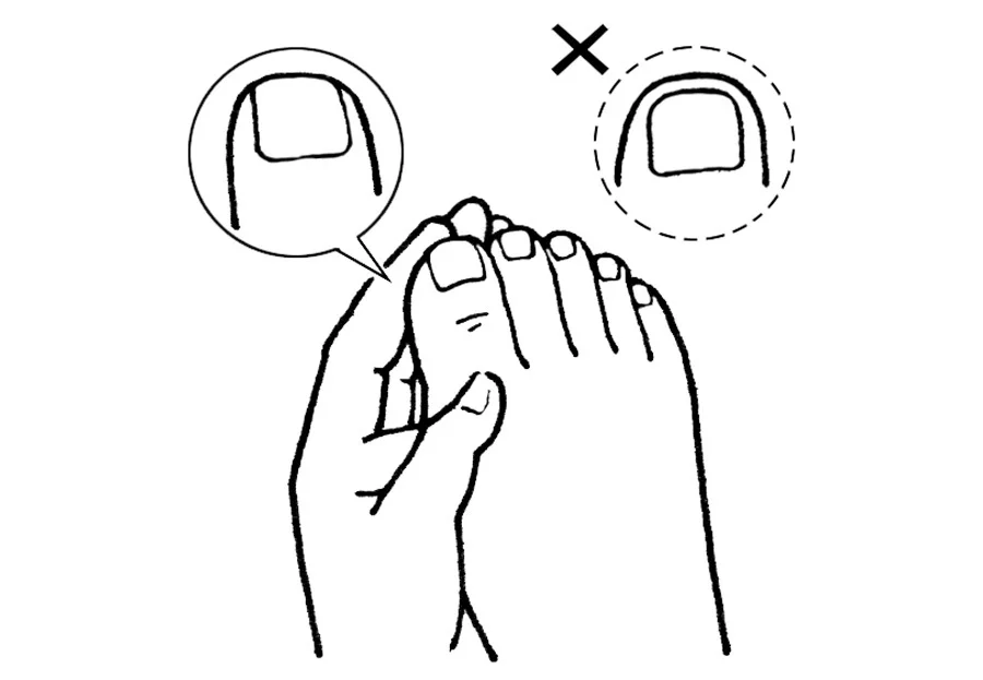 爪まわりのトラブルを防ぐための3つのルール_1_1