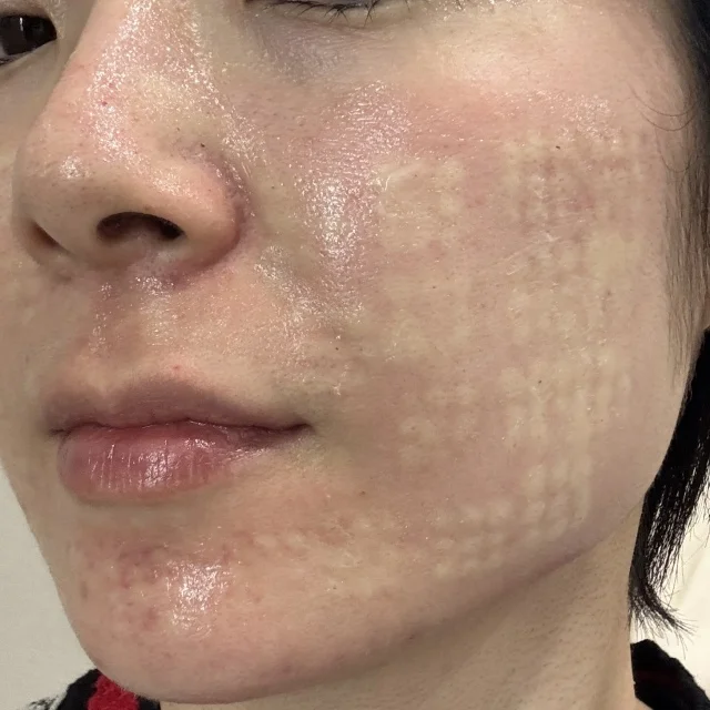 笑顔に自信を取り戻す！40歳からの美容医療デビュー_1_4-2