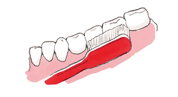 日常生活でまずすべき歯周病ケアって何ですか？【歯周病ケアQ＆A】_1_2-3