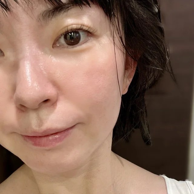 2025年を振り返り！やってよかった美容医療_1_7