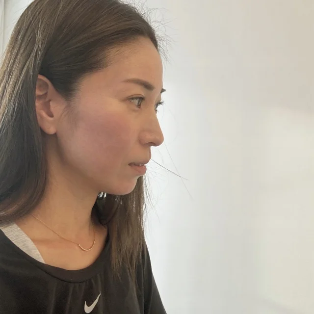 きれいなアゴのラインが出て、目がバッチリ開くように