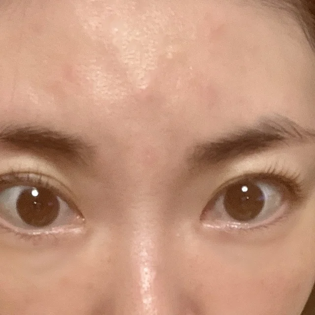 2025年を振り返り！やってよかった美容医療_1_4