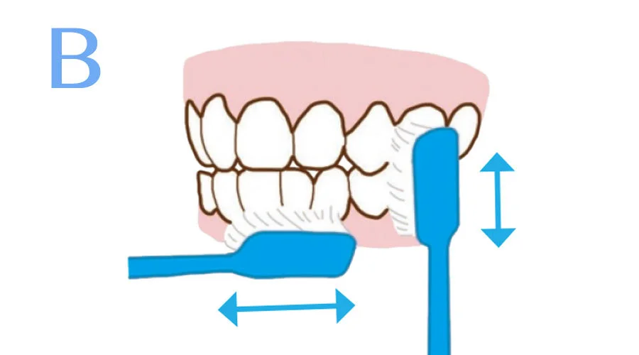 前歯の表面
