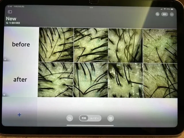 冬の髪悩みは“ひと手間”で変わる！美女組が選んだ最新ヘアケア４選_1_24