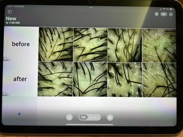 視界が開く、頭が軽い、髪質が変わる。 ヒト幹細胞培養液×極上空間の“銀座本格ヘッドスパ”体験！_1_7