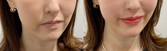 【アラフォー以降の必須美容!?】誕生日記念にリップアートを受けてみた。_1_6