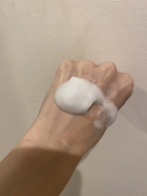 思春期ニキビと我が家の【子宮頚がんワクチン】のお話_1_5-1