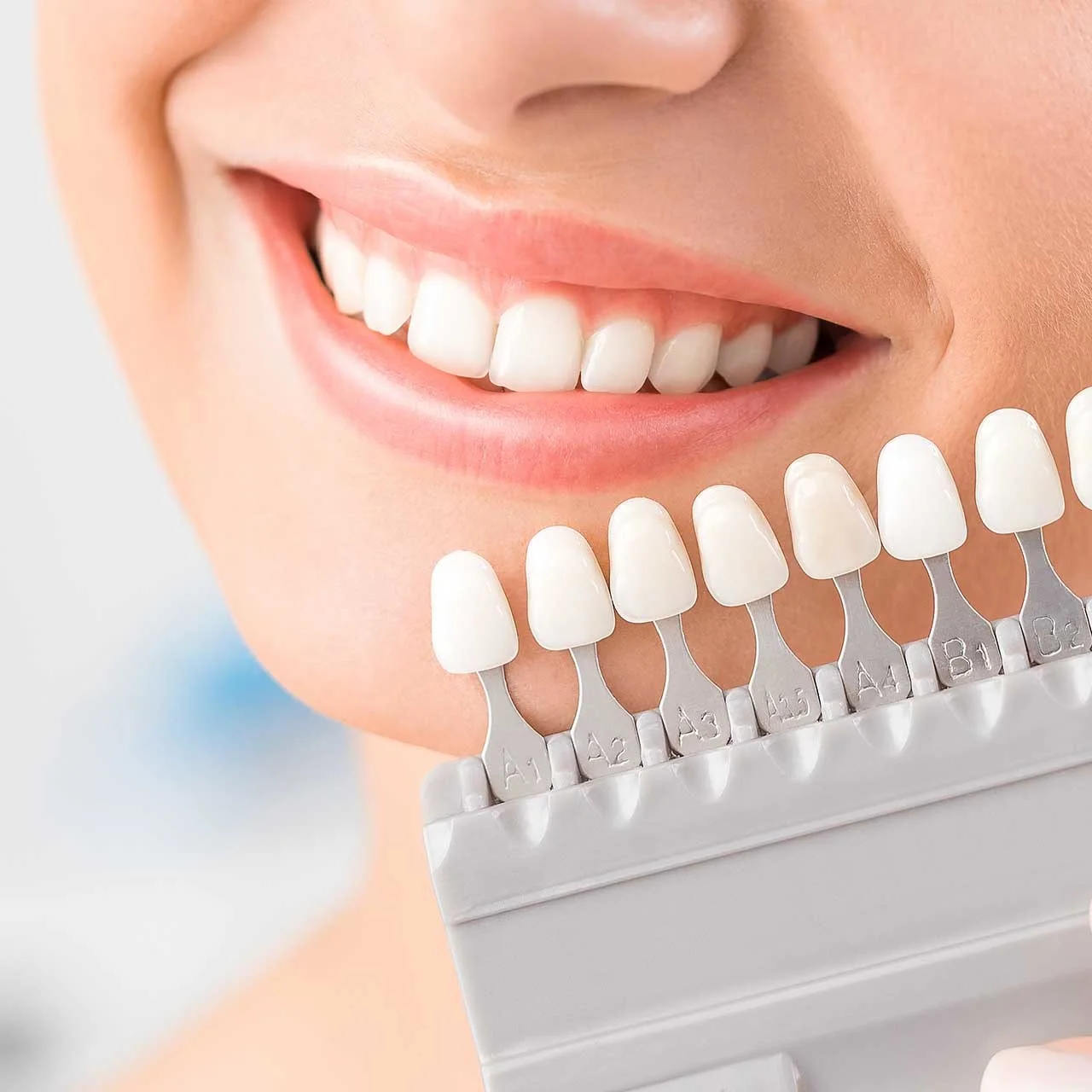 アラフォー女性の9割が「歯の黄ばみ」が気になっている！ 歯のホワイトニングをしている人の割合は？