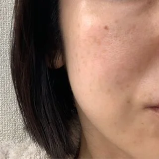 40代の開き毛穴をどうにかしたい！調子がよくなった化粧水と美容クリーム_1_5