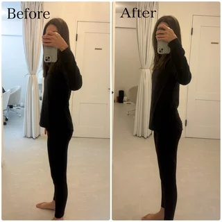 良いことだらけの姿勢改善。巻き肩、ぽっこりお腹、老け顔も解消！